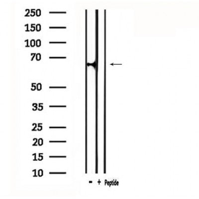 DF4817 staining HepG2 by IF/ICC. The sample were fixed with PFA and permeabilized in 0.1% Triton X-100,then blocked in 10% serum for 45 minutes at 25¡ãC. The primary antibody was diluted at 1/200 and incubated with the sample for 1 hour at 37¡ãC. An  Alexa Fluor 594 conjugated goat anti-rabbit IgG (H+L) Ab, diluted at 1/600, was used as the secondary antibod