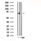 DF4817 staining HepG2 by IF/ICC. The sample were fixed with PFA and permeabilized in 0.1% Triton X-100,then blocked in 10% serum for 45 minutes at 25¡ãC. The primary antibody was diluted at 1/200 and incubated with the sample for 1 hour at 37¡ãC. An  Alexa Fluor 594 conjugated goat anti-rabbit IgG (H+L) Ab, diluted at 1/600, was used as the secondary antibod
