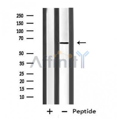 DF4819 staining HeLa by IF/ICC. The sample were fixed with PFA and permeabilized in 0.1% Triton X-100,then blocked in 10% serum for 45 minutes at 25¡ãC. The primary antibody was diluted at 1/200 and incubated with the sample for 1 hour at 37¡ãC. An  Alexa Fluor 594 conjugated goat anti-rabbit IgG (H+L) Ab, diluted at 1/600, was used as the secondary antibod