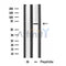 DF4819 staining HeLa by IF/ICC. The sample were fixed with PFA and permeabilized in 0.1% Triton X-100,then blocked in 10% serum for 45 minutes at 25¡ãC. The primary antibody was diluted at 1/200 and incubated with the sample for 1 hour at 37¡ãC. An  Alexa Fluor 594 conjugated goat anti-rabbit IgG (H+L) Ab, diluted at 1/600, was used as the secondary antibod