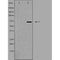 DF4882 staining HeLa by IF/ICC. The sample were fixed with PFA and permeabilized in 0.1% Triton X-100,then blocked in 10% serum for 45 minutes at 25¡ãC. The primary antibody was diluted at 1/200 and incubated with the sample for 1 hour at 37¡ãC. An  Alexa Fluor 594 conjugated goat anti-rabbit IgG (H+L) Ab, diluted at 1/600, was used as the secondary antibod