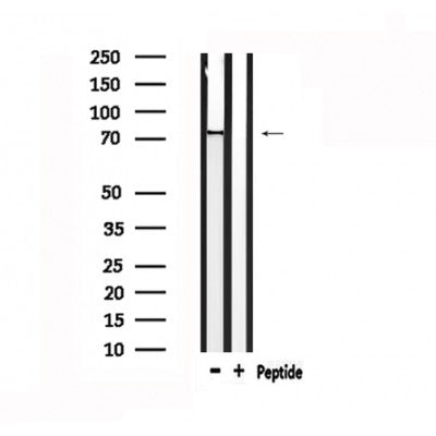 DF4885 staining A549 by IF/ICC. The sample were fixed with PFA and permeabilized in 0.1% Triton X-100,then blocked in 10% serum for 45 minutes at 25¡ãC. The primary antibody was diluted at 1/200 and incubated with the sample for 1 hour at 37¡ãC. An  Alexa Fluor 594 conjugated goat anti-rabbit IgG (H+L) Ab, diluted at 1/600, was used as the secondary antibod