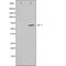 DF4886 staining  HuvEc cells by IF/ICC. The sample were fixed with PFA and permeabilized in 0.1% Triton X-100,then blocked in 10% serum for 45 minutes at 25¡ãC. The primary antibody was diluted at 1/200 and incubated with the sample for 1 hour at 37¡ãC. An  Alexa Fluor 594 conjugated goat anti-rabbit IgG (H+L) antibody(Cat.# S0006), diluted at 1/600, was used as secondary antibod