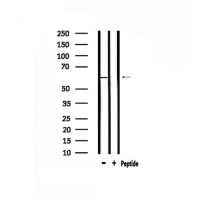 DF4887 staining COLO205 by IF/ICC. The sample were fixed with PFA and permeabilized in 0.1% Triton X-100,then blocked in 10% serum for 45 minutes at 25¡ãC. The primary antibody was diluted at 1/200 and incubated with the sample for 1 hour at 37¡ãC. An  Alexa Fluor 594 conjugated goat anti-rabbit IgG (H+L) Ab, diluted at 1/600, was used as the secondary antibod