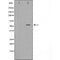 DF4976 staining LOVO by IF/ICC. The sample were fixed with PFA and permeabilized in 0.1% Triton X-100,then blocked in 10% serum for 45 minutes at 25¡ãC. The primary antibody was diluted at 1/200 and incubated with the sample for 1 hour at 37¡ãC. An  Alexa Fluor 594 conjugated goat anti-rabbit IgG (H+L) Ab, diluted at 1/600, was used as the secondary antibod