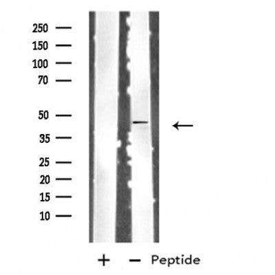 DF4820 staining COLO205 by IF/ICC. The sample were fixed with PFA and permeabilized in 0.1% Triton X-100,then blocked in 10% serum for 45 minutes at 25¡ãC. The primary antibody was diluted at 1/200 and incubated with the sample for 1 hour at 37¡ãC. An  Alexa Fluor 594 conjugated goat anti-rabbit IgG (H+L) Ab, diluted at 1/600, was used as the secondary antibod