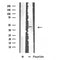 DF4820 staining COLO205 by IF/ICC. The sample were fixed with PFA and permeabilized in 0.1% Triton X-100,then blocked in 10% serum for 45 minutes at 25¡ãC. The primary antibody was diluted at 1/200 and incubated with the sample for 1 hour at 37¡ãC. An  Alexa Fluor 594 conjugated goat anti-rabbit IgG (H+L) Ab, diluted at 1/600, was used as the secondary antibod