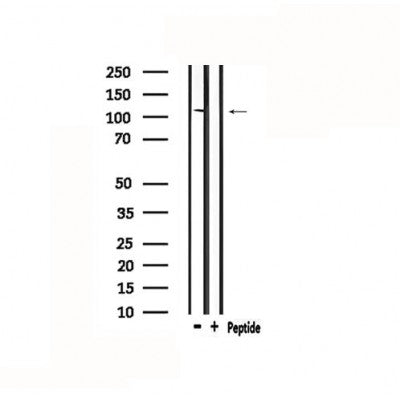 DF4821 staining 293 cells by IF/ICC. The sample were fixed with PFA and permeabilized in 0.1% Triton X-100,then blocked in 10% serum for 45 minutes at 25¡ãC. The primary antibody was diluted at 1/200 and incubated with the sample for 1 hour at 37¡ãC. An  Alexa Fluor 594 conjugated goat anti-rabbit IgG (H+L) antibody(Cat.# S0006), diluted at 1/600, was used as secondary antibod