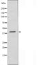 DF4822 staining COLO205 cells by IF/ICC. The sample were fixed with PFA and permeabilized in 0.1% Triton X-100,then blocked in 10% serum for 45 minutes at 25¡ãC. The primary antibody was diluted at 1/200 and incubated with the sample for 1 hour at 37¡ãC. An  Alexa Fluor 594 conjugated goat anti-rabbit IgG (H+L) antibody(Cat.# S0006), diluted at 1/600, was used as secondary antibod
