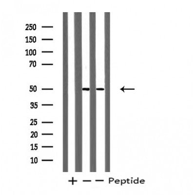 DF4823 staining HepG2 by IF/ICC. The sample were fixed with PFA and permeabilized in 0.1% Triton X-100,then blocked in 10% serum for 45 minutes at 25¡ãC. The primary antibody was diluted at 1/200 and incubated with the sample for 1 hour at 37¡ãC. An  Alexa Fluor 594 conjugated goat anti-rabbit IgG (H+L) Ab, diluted at 1/600, was used as the secondary antibod
