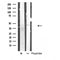 DF4826 staining  COLO205 cells by IF/ICC. The sample were fixed with PFA and permeabilized in 0.1% Triton X-100,then blocked in 10% serum for 45 minutes at 25¡ãC. The primary antibody was diluted at 1/200 and incubated with the sample for 1 hour at 37¡ãC. An  Alexa Fluor 594 conjugated goat anti-rabbit IgG (H+L) antibody(Cat.# S0006), diluted at 1/600, was used as secondary antibod