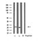 DF4828 staining  Hela cells by IF/ICC. The sample were fixed with PFA and permeabilized in 0.1% Triton X-100,then blocked in 10% serum for 45 minutes at 25¡ãC. The primary antibody was diluted at 1/200 and incubated with the sample for 1 hour at 37¡ãC. An  Alexa Fluor 594 conjugated goat anti-rabbit IgG (H+L) antibody(Cat.# S0006), diluted at 1/600, was used as secondary antibod
