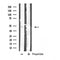 DF4829 at 1/100 staining Human uterus tissue by IHC-P. The sample was formaldehyde fixed and a heat mediated antigen retrieval step in citrate buffer was performed. The sample was then blocked and incubated with the antibody for 1.5 hours at 22¡ãC. An HRP conjugated goat anti-rabbit antibody was used as the secondary