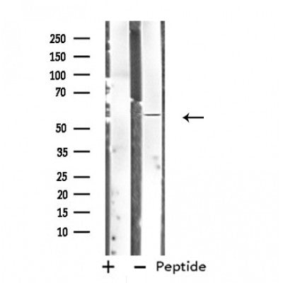 DF4830 staining Hela by IF/ICC. The sample were fixed with PFA and permeabilized in 0.1% Triton X-100,then blocked in 10% serum for 45 minutes at 25¡ãC. The primary antibody was diluted at 1/200 and incubated with the sample for 1 hour at 37¡ãC. An  Alexa Fluor 594 conjugated goat anti-rabbit IgG (H+L) Ab, diluted at 1/600, was used as the secondary antibod
