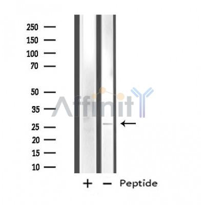 DF4832 at 1/100 staining Human Melanoma tissue by IHC-P. The sample was formaldehyde fixed and a heat mediated antigen retrieval step in citrate buffer was performed. The sample was then blocked and incubated with the antibody for 1.5 hours at 22¡ãC. An HRP conjugated goat anti-rabbit antibody was used as the secondary