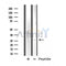 DF4832 at 1/100 staining Human Melanoma tissue by IHC-P. The sample was formaldehyde fixed and a heat mediated antigen retrieval step in citrate buffer was performed. The sample was then blocked and incubated with the antibody for 1.5 hours at 22¡ãC. An HRP conjugated goat anti-rabbit antibody was used as the secondary
