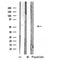 Western blot analysis of extracts from various samples, using INA Antibody.  Lane 1: Hela treated with blocking peptide;  Lane 2: Hela; Lane 3: Mouse lung.