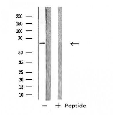Western blot analysis of extracts from HepG2, using GPC5 Antibody. Lane 1 was treated with the blocking peptide.