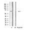 Western blot analysis of extracts from HepG2, using GPC5 Antibody. Lane 1 was treated with the blocking peptide.
