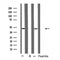 Western blot analysis of extracts from various samples, using RUNX3 Antibody.
 Lane 1: HepG2 treated with blocking peptide;
 Lane 2: HepG2;
 Lane 3: 293.