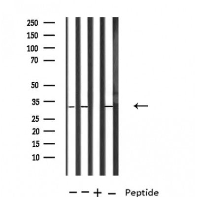 DF4836 at 1/100 staining Human lung tissue by IHC-P. The sample was formaldehyde fixed and a heat mediated antigen retrieval step in citrate buffer was performed. The sample was then blocked and incubated with the antibody for 1.5 hours at 22¡ãC. An HRP conjugated goat anti-rabbit antibody was used as the secondary