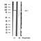 DF4837 staining Hela by IF/ICC. The sample were fixed with PFA and permeabilized in 0.1% Triton X-100,then blocked in 10% serum for 45 minutes at 25¡ãC. The primary antibody was diluted at 1/200 and incubated with the sample for 1 hour at 37¡ãC. An  Alexa Fluor 594 conjugated goat anti-rabbit IgG (H+L) Ab, diluted at 1/600, was used as the secondary antibod