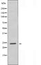 DF4838 staining  A549 cells by IF/ICC. The sample were fixed with PFA and permeabilized in 0.1% Triton X-100,then blocked in 10% serum for 45 minutes at 25¡ãC. The primary antibody was diluted at 1/200 and incubated with the sample for 1 hour at 37¡ãC. An  Alexa Fluor 594 conjugated goat anti-rabbit IgG (H+L) antibody(Cat.# S0006), diluted at 1/600, was used as secondary antibod