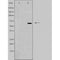 DF4839 staining HepG2 by IF/ICC. The sample were fixed with PFA and permeabilized in 0.1% Triton X-100,then blocked in 10% serum for 45 minutes at 25¡ãC. The primary antibody was diluted at 1/200 and incubated with the sample for 1 hour at 37¡ãC. An  Alexa Fluor 594 conjugated goat anti-rabbit IgG (H+L) Ab, diluted at 1/600, was used as the secondary antibod