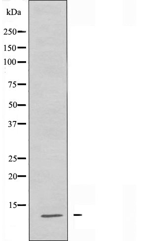 DF4842 staining Hela by IF/ICC. The sample were fixed with PFA and permeabilized in 0.1% Triton X-100,then blocked in 10% serum for 45 minutes at 25¡ãC. The primary antibody was diluted at 1/200 and incubated with the sample for 1 hour at 37¡ãC. An  Alexa Fluor 594 conjugated goat anti-rabbit IgG (H+L) Ab, diluted at 1/600, was used as the secondary antibod