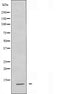 DF4842 staining Hela by IF/ICC. The sample were fixed with PFA and permeabilized in 0.1% Triton X-100,then blocked in 10% serum for 45 minutes at 25¡ãC. The primary antibody was diluted at 1/200 and incubated with the sample for 1 hour at 37¡ãC. An  Alexa Fluor 594 conjugated goat anti-rabbit IgG (H+L) Ab, diluted at 1/600, was used as the secondary antibod