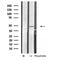 Western blot analysis of extracts from Jurkat cells, using HTR2C antibody.