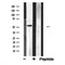 DF4852 staining lOVO by IF/ICC. The sample were fixed with PFA and permeabilized in 0.1% Triton X-100,then blocked in 10% serum for 45 minutes at 25¡ãC. The primary antibody was diluted at 1/200 and incubated with the sample for 1 hour at 37¡ãC. An  Alexa Fluor 594 conjugated goat anti-rabbit IgG (H+L) Ab, diluted at 1/600, was used as the secondary antibod