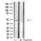 DF4854 staining HuvEc by IF/ICC. The sample were fixed with PFA and permeabilized in 0.1% Triton X-100,then blocked in 10% serum for 45 minutes at 25¡ãC. The primary antibody was diluted at 1/200 and incubated with the sample for 1 hour at 37¡ãC. An  Alexa Fluor 594 conjugated goat anti-rabbit IgG (H+L) Ab, diluted at 1/600, was used as the secondary antibod