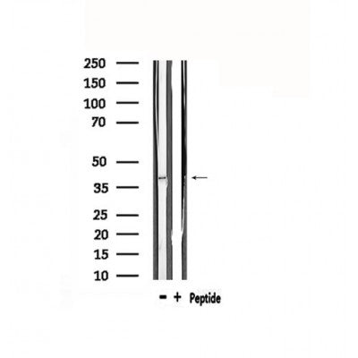 DF4856 staining Hela by IF/ICC. The sample were fixed with PFA and permeabilized in 0.1% Triton X-100,then blocked in 10% serum for 45 minutes at 25¡ãC. The primary antibody was diluted at 1/200 and incubated with the sample for 1 hour at 37¡ãC. An  Alexa Fluor 594 conjugated goat anti-rabbit IgG (H+L) Ab, diluted at 1/600, was used as the secondary antibod