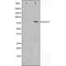 Western blot analysis on HeLa cell lysate using RAD17 Antibody.The lane on the left is treated with the antigen-specific peptide.