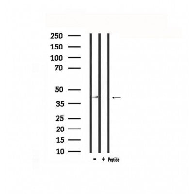 Western blot analysis of extracts from Hela, using CXCR3 Antibody.
