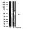 DF4861 staining A549 by IF/ICC. The sample were fixed with PFA and permeabilized in 0.1% Triton X-100,then blocked in 10% serum for 45 minutes at 25¡ãC. The primary antibody was diluted at 1/200 and incubated with the sample for 1 hour at 37¡ãC. An  Alexa Fluor 594 conjugated goat anti-rabbit IgG (H+L) Ab, diluted at 1/600, was used as the secondary antibod