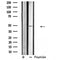 DF4864 staining COLO205 by IF/ICC. The sample were fixed with PFA and permeabilized in 0.1% Triton X-100,then blocked in 10% serum for 45 minutes at 25¡ãC. The primary antibody was diluted at 1/200 and incubated with the sample for 1 hour at 37¡ãC. An  Alexa Fluor 594 conjugated goat anti-rabbit IgG (H+L) Ab, diluted at 1/600, was used as the secondary antibod