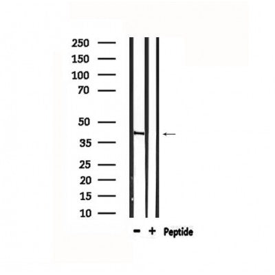 DF4865 staining COLO205 by IF/ICC. The sample were fixed with PFA and permeabilized in 0.1% Triton X-100,then blocked in 10% serum for 45 minutes at 25¡ãC. The primary antibody was diluted at 1/200 and incubated with the sample for 1 hour at 37¡ãC. An  Alexa Fluor 594 conjugated goat anti-rabbit IgG (H+L) Ab, diluted at 1/600, was used as the secondary antibod