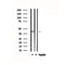 DF4865 staining COLO205 by IF/ICC. The sample were fixed with PFA and permeabilized in 0.1% Triton X-100,then blocked in 10% serum for 45 minutes at 25¡ãC. The primary antibody was diluted at 1/200 and incubated with the sample for 1 hour at 37¡ãC. An  Alexa Fluor 594 conjugated goat anti-rabbit IgG (H+L) Ab, diluted at 1/600, was used as the secondary antibod