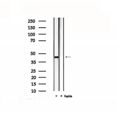 DF4867 staining 293T by IF/ICC. The sample were fixed with PFA and permeabilized in 0.1% Triton X-100,then blocked in 10% serum for 45 minutes at 25¡ãC. The primary antibody was diluted at 1/200 and incubated with the sample for 1 hour at 37¡ãC. An  Alexa Fluor 594 conjugated goat anti-rabbit IgG (H+L) Ab, diluted at 1/600, was used as the secondary antibod
