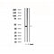 DF4867 staining 293T by IF/ICC. The sample were fixed with PFA and permeabilized in 0.1% Triton X-100,then blocked in 10% serum for 45 minutes at 25¡ãC. The primary antibody was diluted at 1/200 and incubated with the sample for 1 hour at 37¡ãC. An  Alexa Fluor 594 conjugated goat anti-rabbit IgG (H+L) Ab, diluted at 1/600, was used as the secondary antibod