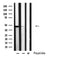 DF4868 at 1/100 staining Human lung tissue by IHC-P. The sample was formaldehyde fixed and a heat mediated antigen retrieval step in citrate buffer was performed. The sample was then blocked and incubated with the antibody for 1.5 hours at 22¡ãC. An HRP conjugated goat anti-rabbit antibody was used as the secondary