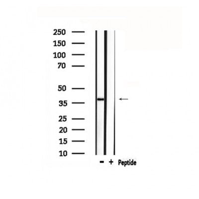 DF4873 staining Hela by IF/ICC. The sample were fixed with PFA and permeabilized in 0.1% Triton X-100,then blocked in 10% serum for 45 minutes at 25¡ãC. The primary antibody was diluted at 1/200 and incubated with the sample for 1 hour at 37¡ãC. An  Alexa Fluor 594 conjugated goat anti-rabbit IgG (H+L) Ab, diluted at 1/600, was used as the secondary antibod
