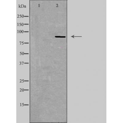 DF4875 staining COLO205 by IF/ICC. The sample were fixed with PFA and permeabilized in 0.1% Triton X-100,then blocked in 10% serum for 45 minutes at 25¡ãC. The primary antibody was diluted at 1/200 and incubated with the sample for 1 hour at 37¡ãC. An  Alexa Fluor 594 conjugated goat anti-rabbit IgG (H+L) Ab, diluted at 1/600, was used as the secondary antibod