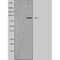 DF4875 staining COLO205 by IF/ICC. The sample were fixed with PFA and permeabilized in 0.1% Triton X-100,then blocked in 10% serum for 45 minutes at 25¡ãC. The primary antibody was diluted at 1/200 and incubated with the sample for 1 hour at 37¡ãC. An  Alexa Fluor 594 conjugated goat anti-rabbit IgG (H+L) Ab, diluted at 1/600, was used as the secondary antibod