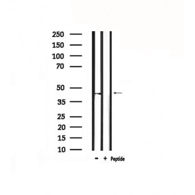 DF4877 staining MCF7 by IF/ICC. The sample were fixed with PFA and permeabilized in 0.1% Triton X-100,then blocked in 10% serum for 45 minutes at 25¡ãC. The primary antibody was diluted at 1/200 and incubated with the sample for 1 hour at 37¡ãC. An  Alexa Fluor 594 conjugated goat anti-rabbit IgG (H+L) Ab, diluted at 1/600, was used as the secondary antibod