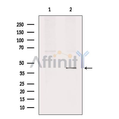 Western blot analysis of extracts from 293, using PE2R2 Antibody. Lane 1 was treated with the blocking peptide.