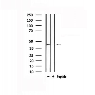 DF4890 staining RAW264.7 by IF/ICC. The sample were fixed with PFA and permeabilized in 0.1% Triton X-100,then blocked in 10% serum for 45 minutes at 25¡ãC. The primary antibody was diluted at 1/200 and incubated with the sample for 1 hour at 37¡ãC. An  Alexa Fluor 594 conjugated goat anti-rabbit IgG (H+L) Ab, diluted at 1/600, was used as the secondary antibod
