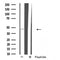 DF4896 staining HuvEc by IF/ICC. The sample were fixed with PFA and permeabilized in 0.1% Triton X-100,then blocked in 10% serum for 45 minutes at 25¡ãC. The primary antibody was diluted at 1/200 and incubated with the sample for 1 hour at 37¡ãC. An  Alexa Fluor 594 conjugated goat anti-rabbit IgG (H+L) Ab, diluted at 1/600, was used as the secondary antibod